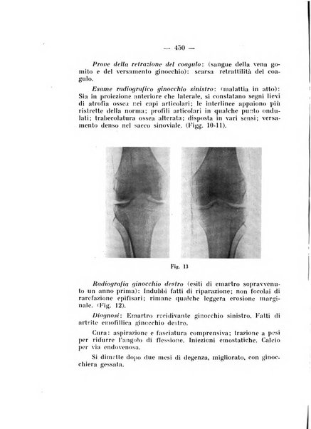 Archivio di ortopedia pubblicazione ufficiale del Pio istituto dei rachitici <1924-1950>