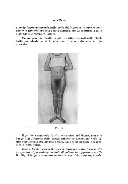 Archivio di ortopedia pubblicazione ufficiale del Pio istituto dei rachitici <1924-1950>