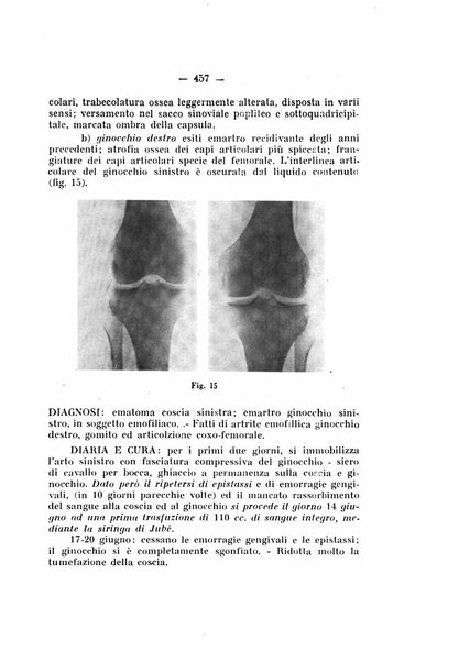 Archivio di ortopedia pubblicazione ufficiale del Pio istituto dei rachitici <1924-1950>