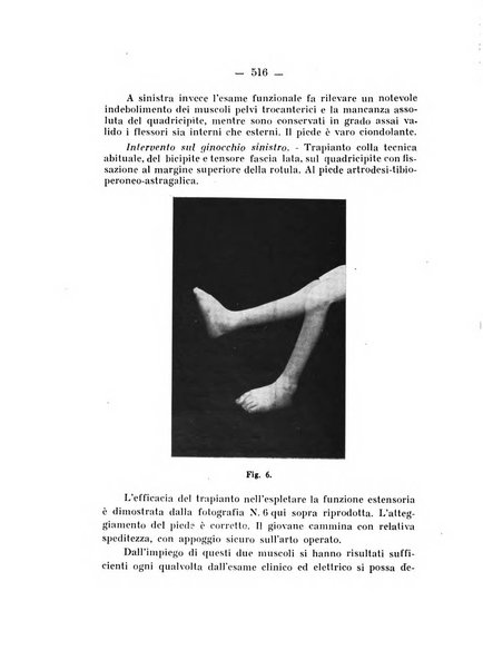 Archivio di ortopedia pubblicazione ufficiale del Pio istituto dei rachitici <1924-1950>