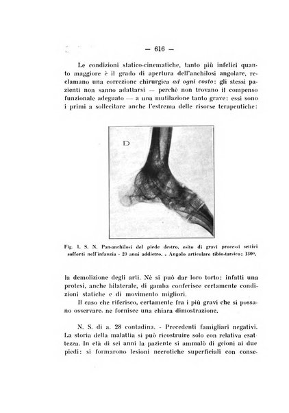 Archivio di ortopedia pubblicazione ufficiale del Pio istituto dei rachitici <1924-1950>