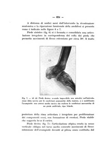 Archivio di ortopedia pubblicazione ufficiale del Pio istituto dei rachitici <1924-1950>