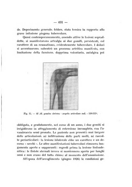 Archivio di ortopedia pubblicazione ufficiale del Pio istituto dei rachitici <1924-1950>