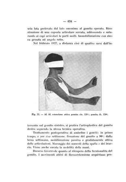 Archivio di ortopedia pubblicazione ufficiale del Pio istituto dei rachitici <1924-1950>