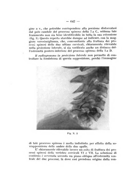 Archivio di ortopedia pubblicazione ufficiale del Pio istituto dei rachitici <1924-1950>