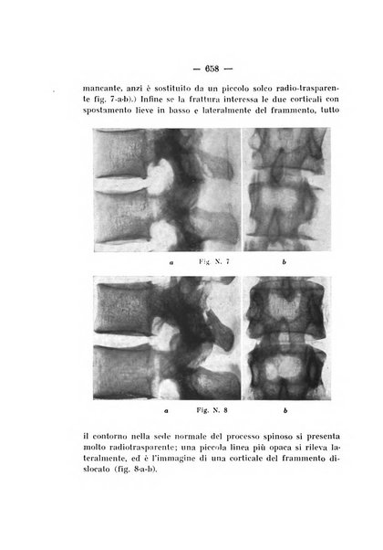 Archivio di ortopedia pubblicazione ufficiale del Pio istituto dei rachitici <1924-1950>