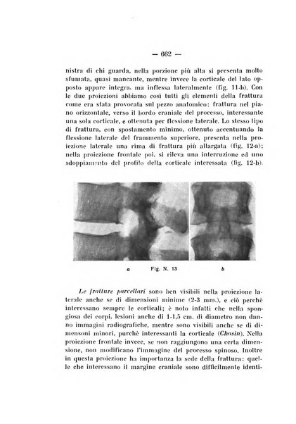 Archivio di ortopedia pubblicazione ufficiale del Pio istituto dei rachitici <1924-1950>