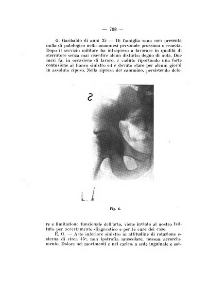 Archivio di ortopedia pubblicazione ufficiale del Pio istituto dei rachitici <1924-1950>