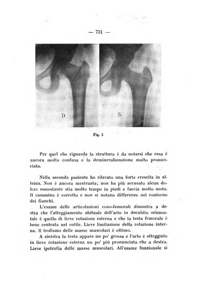 Archivio di ortopedia pubblicazione ufficiale del Pio istituto dei rachitici <1924-1950>