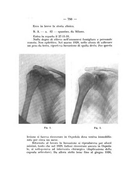 Archivio di ortopedia pubblicazione ufficiale del Pio istituto dei rachitici <1924-1950>