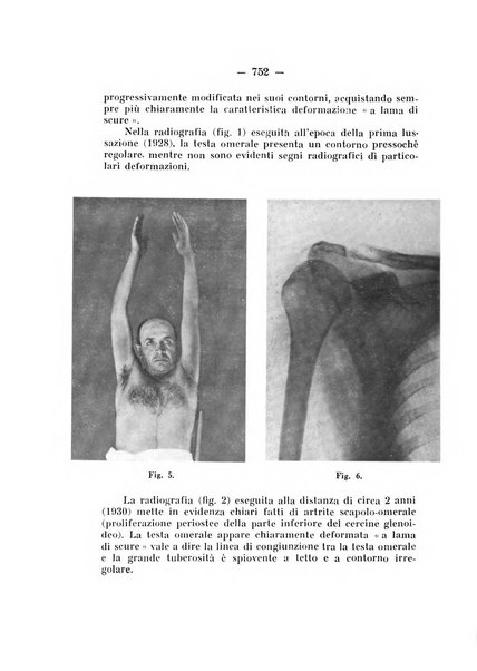 Archivio di ortopedia pubblicazione ufficiale del Pio istituto dei rachitici <1924-1950>