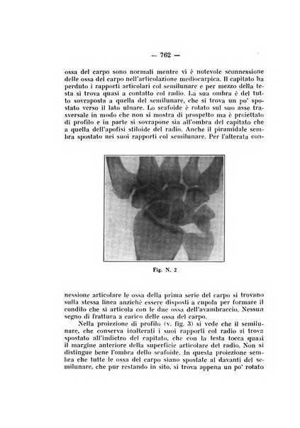 Archivio di ortopedia pubblicazione ufficiale del Pio istituto dei rachitici <1924-1950>