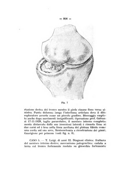 Archivio di ortopedia pubblicazione ufficiale del Pio istituto dei rachitici <1924-1950>