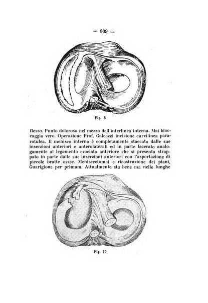 Archivio di ortopedia pubblicazione ufficiale del Pio istituto dei rachitici <1924-1950>