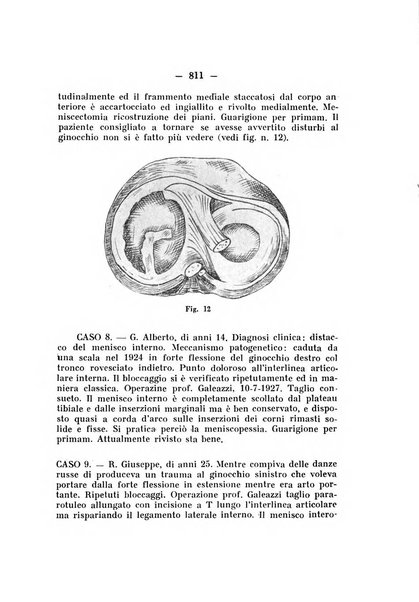 Archivio di ortopedia pubblicazione ufficiale del Pio istituto dei rachitici <1924-1950>