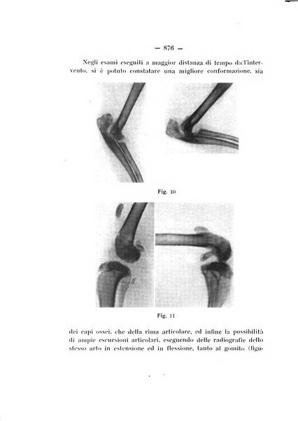 Archivio di ortopedia pubblicazione ufficiale del Pio istituto dei rachitici <1924-1950>