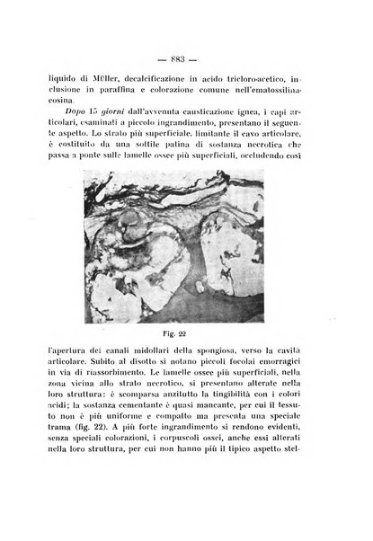 Archivio di ortopedia pubblicazione ufficiale del Pio istituto dei rachitici <1924-1950>