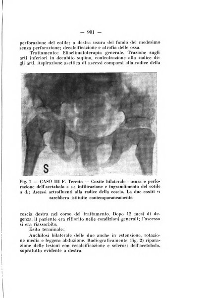 Archivio di ortopedia pubblicazione ufficiale del Pio istituto dei rachitici <1924-1950>