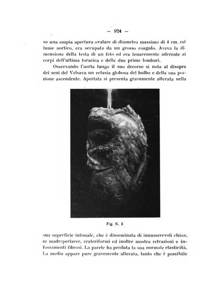 Archivio di ortopedia pubblicazione ufficiale del Pio istituto dei rachitici <1924-1950>