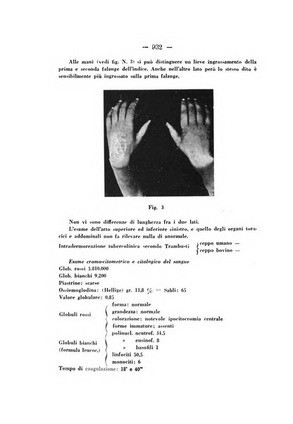 Archivio di ortopedia pubblicazione ufficiale del Pio istituto dei rachitici <1924-1950>