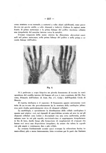 Archivio di ortopedia pubblicazione ufficiale del Pio istituto dei rachitici <1924-1950>