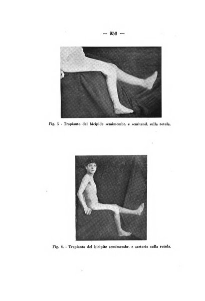 Archivio di ortopedia pubblicazione ufficiale del Pio istituto dei rachitici <1924-1950>