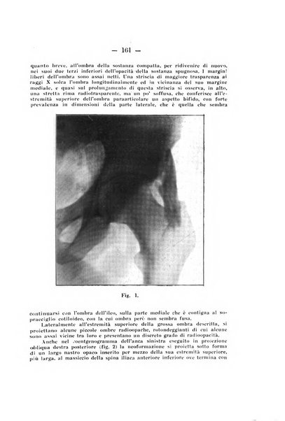 Archivio di ortopedia pubblicazione ufficiale del Pio istituto dei rachitici <1924-1950>