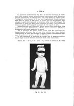 giornale/TO00176849/1933/unico/00000190