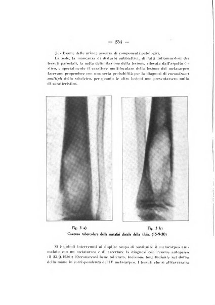 Archivio di ortopedia pubblicazione ufficiale del Pio istituto dei rachitici <1924-1950>