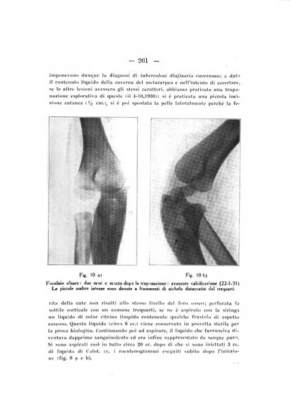 Archivio di ortopedia pubblicazione ufficiale del Pio istituto dei rachitici <1924-1950>