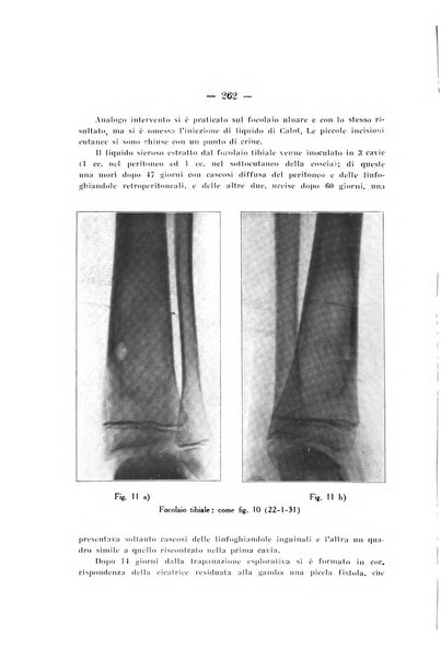 Archivio di ortopedia pubblicazione ufficiale del Pio istituto dei rachitici <1924-1950>