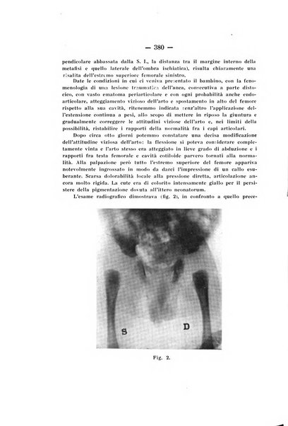 Archivio di ortopedia pubblicazione ufficiale del Pio istituto dei rachitici <1924-1950>