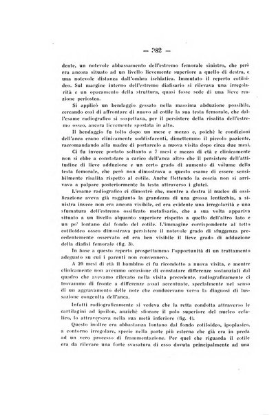 Archivio di ortopedia pubblicazione ufficiale del Pio istituto dei rachitici <1924-1950>