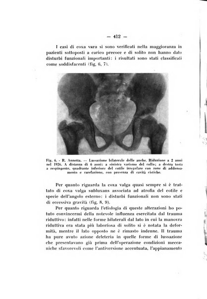 Archivio di ortopedia pubblicazione ufficiale del Pio istituto dei rachitici <1924-1950>