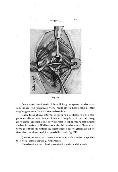 Archivio di ortopedia pubblicazione ufficiale del Pio istituto dei rachitici <1924-1950>