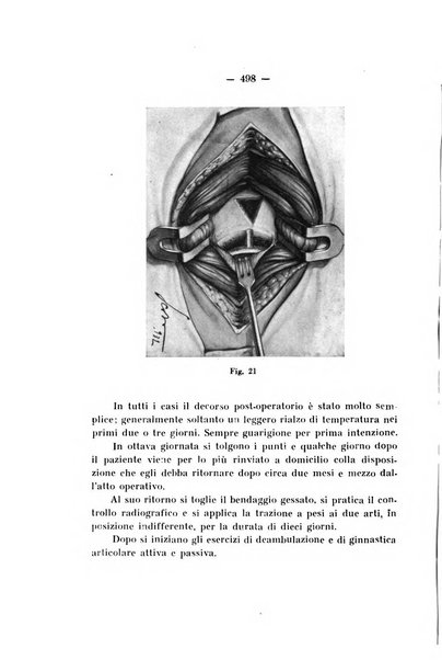 Archivio di ortopedia pubblicazione ufficiale del Pio istituto dei rachitici <1924-1950>