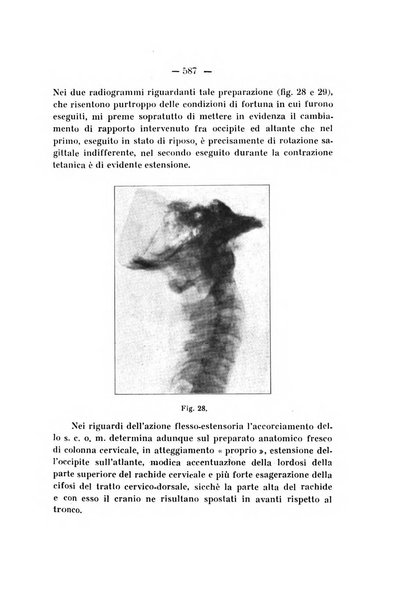 Archivio di ortopedia pubblicazione ufficiale del Pio istituto dei rachitici <1924-1950>