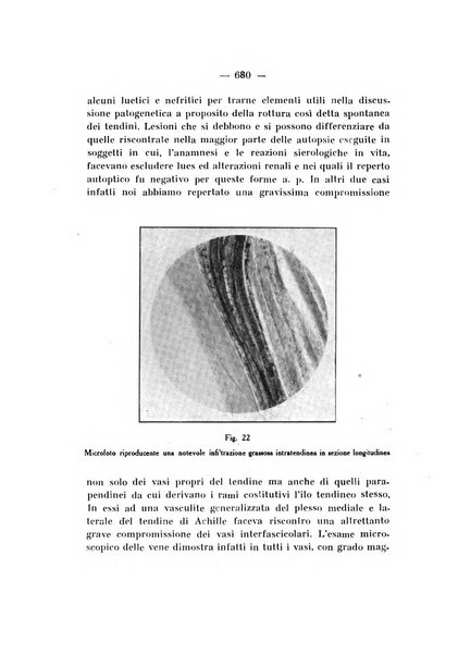 Archivio di ortopedia pubblicazione ufficiale del Pio istituto dei rachitici <1924-1950>