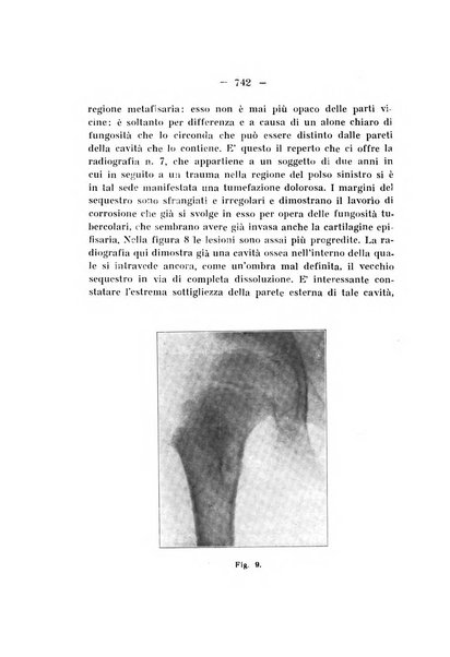 Archivio di ortopedia pubblicazione ufficiale del Pio istituto dei rachitici <1924-1950>