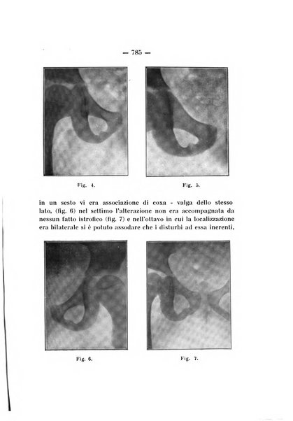 Archivio di ortopedia pubblicazione ufficiale del Pio istituto dei rachitici <1924-1950>