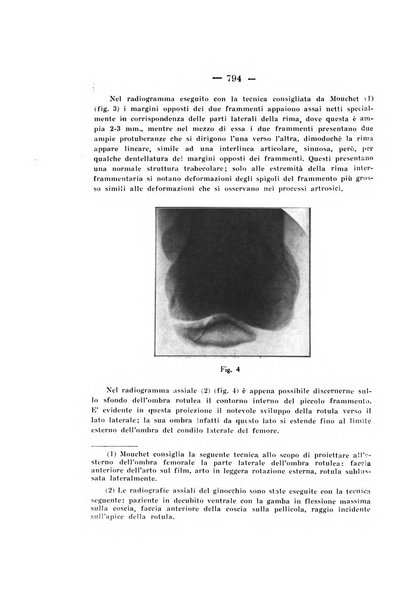 Archivio di ortopedia pubblicazione ufficiale del Pio istituto dei rachitici <1924-1950>