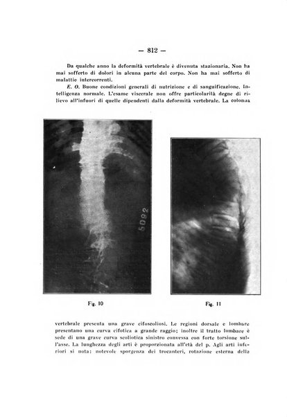 Archivio di ortopedia pubblicazione ufficiale del Pio istituto dei rachitici <1924-1950>