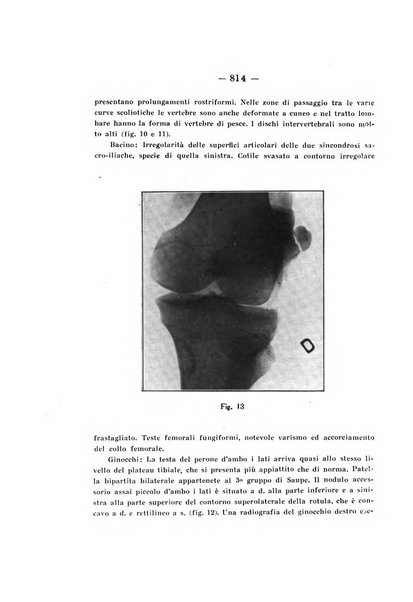 Archivio di ortopedia pubblicazione ufficiale del Pio istituto dei rachitici <1924-1950>