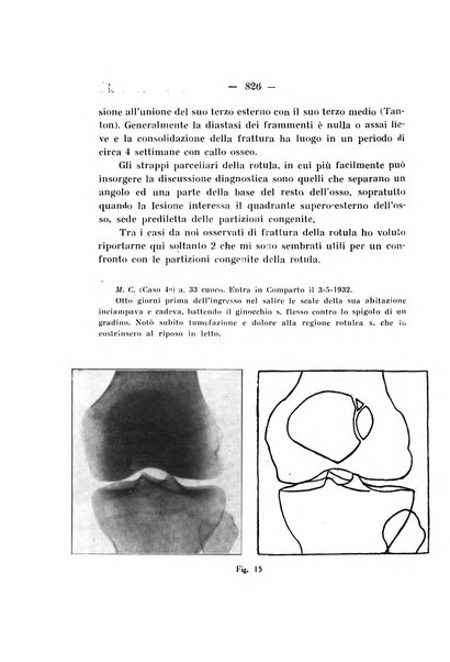 Archivio di ortopedia pubblicazione ufficiale del Pio istituto dei rachitici <1924-1950>