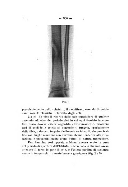 Archivio di ortopedia pubblicazione ufficiale del Pio istituto dei rachitici <1924-1950>