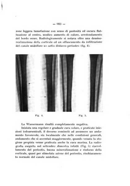 Archivio di ortopedia pubblicazione ufficiale del Pio istituto dei rachitici <1924-1950>