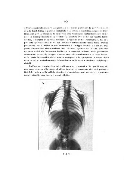 Archivio di ortopedia pubblicazione ufficiale del Pio istituto dei rachitici <1924-1950>