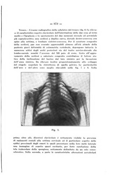 Archivio di ortopedia pubblicazione ufficiale del Pio istituto dei rachitici <1924-1950>