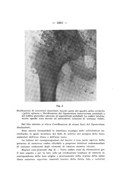 Archivio di ortopedia pubblicazione ufficiale del Pio istituto dei rachitici <1924-1950>