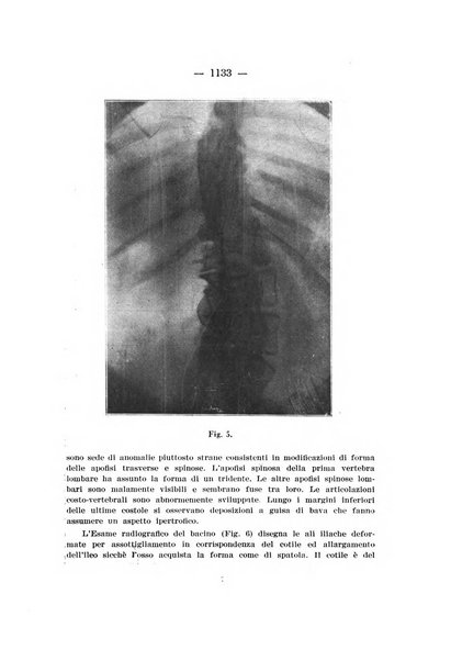 Archivio di ortopedia pubblicazione ufficiale del Pio istituto dei rachitici <1924-1950>